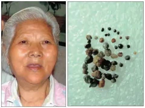 阿不问法:现代有往生西方极乐世界的实例吗?-图片5